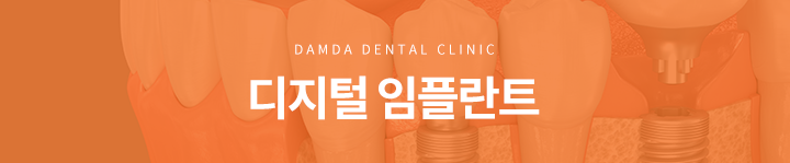 디지털 임플란트