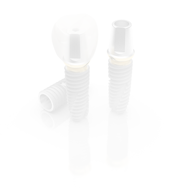 디지털 임플란트